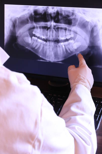 Best Emergency Dentist for Lost Fillings or Crowns in Hanley Hills, MO