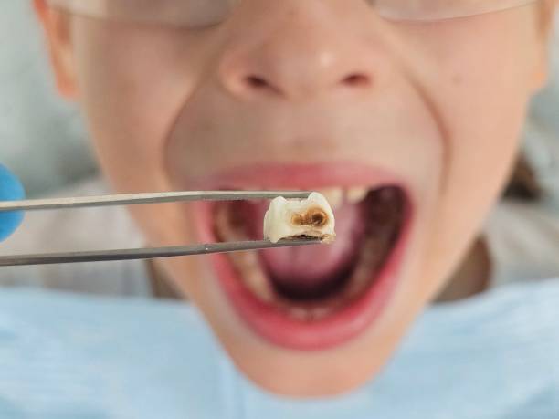 Best Emergency Dental Services for Seniors in Hanley Hills, MO
